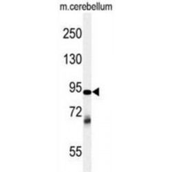 Ubiquitin Thioesterase ZRANB1 (ZRANB1) Antibody