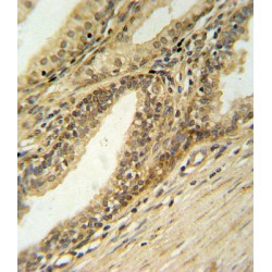 DNA Fragmentation Factor Subunit Beta (DFFB) Antibody