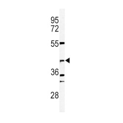 DNA Fragmentation Factor Subunit Beta (DFFB) Antibody