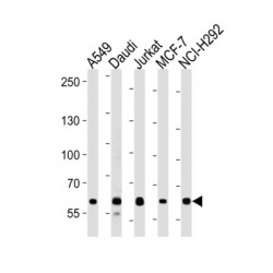 Forkhead Box Protein P1 (FOXP1) Antibody