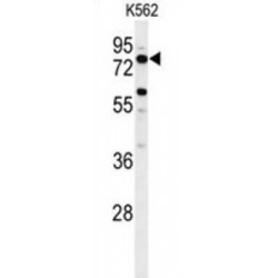 Long-Chain-Fatty-Acid-CoA Ligase ACSBG2 (ACBG2) Antibody
