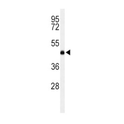 Phosphatidylcholine-Sterol Acyltransferase (LCAT) Antibody