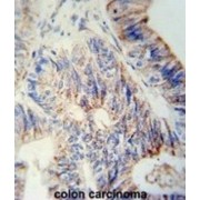 N-Acetyllactosaminide Beta-1,3-N-Acetylglucosaminyltransferase 6 (B3GNT6) Antibody