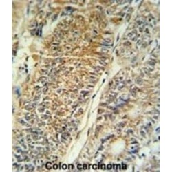 Pyrroline-5-Carboxylate Reductase 1, Mitochondrial (PYCR1) Antibody