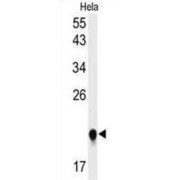 WB analysis of HeLa cell lysates (35 µg).