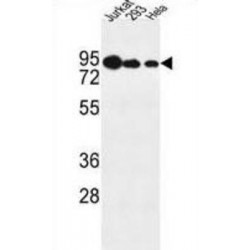 Nucleolar Protein 9 (NOL9) Antibody