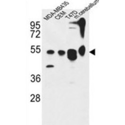 Autophagy-Related Protein 13 (ATG13) Antibody