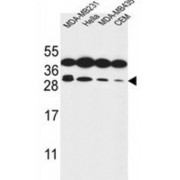 Syntaxin 10 (STX10) Antibody