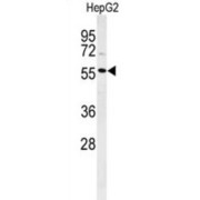 DNA Polymerase Lambda (POLL) Antibody