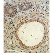 Muellerian-Inhibiting Factor (AMH) Antibody