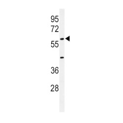 Muellerian-Inhibiting Factor (AMH) Antibody