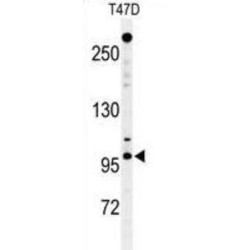 Nucleoporin 210 kDa / gp210 (NUP210) Antibody