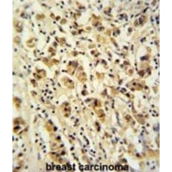 DEAD (Asp-Glu-Ala-Asp) Box Polypeptide 49 (DDX49) Antibody