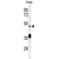 DEAD (Asp-Glu-Ala-Asp) Box Polypeptide 49 (DDX49) Antibody