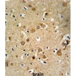 Delta-Like Protein 4 (DLL4) Antibody