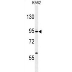 Delta-Like Protein 4 (DLL4) Antibody