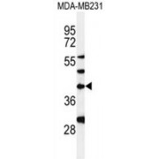Dolichyl Phosphate-N-Acetylglucosaminephosphotransferase 1 (DPAGT1) Antibody