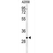 Brain Acid Soluble Protein 1 (BASP1) Antibody