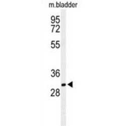 Brain Acid Soluble Protein 1 (BASP1) Antibody