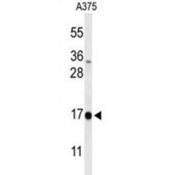 DAZ Associated Protein 2 (DAZAP2) Antibody