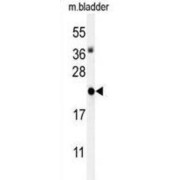 WB analysis of Mouse bladder tissue lysate, using DNA-Binding Protein Inhibitor ID-4 (ID4) antibody (35 µg lysate/lane). ID4 protein detection is demonstrated by the arrow.