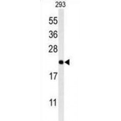 Melanocortin 2 Receptor Accessory Protein (MRAP) Antibody