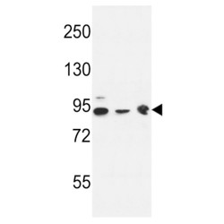 Putative Tyrosine-Protein Phosphatase Auxilin (DNAJC6) Antibody