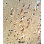 HBV X Protein Up-Regulated Gene 4 Protein (URG4) Antibody