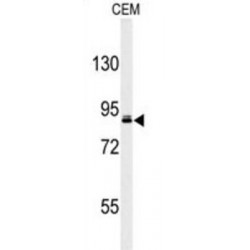 HBV X Protein Up-Regulated Gene 4 Protein (URG4) Antibody