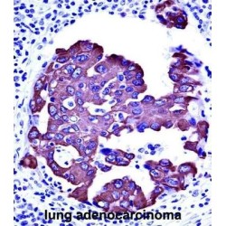 Cytokeratin-18 (CYK18) Antibody