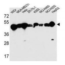 Cytokeratin-18 (CYK18) Antibody