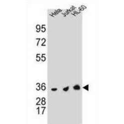 Thymidylate Synthase (TYMS) Antibody