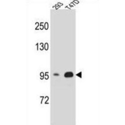 Catenin Beta 1 (CTNNB1) Antibody