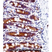 SRC Proto-Oncogene, Non-Receptor Tyrosine Kinase (SRC) Antibody