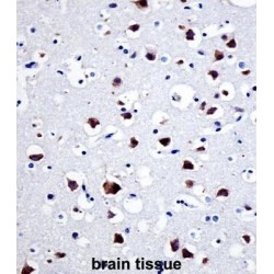 SRC Proto-Oncogene, Non-Receptor Tyrosine Kinase (SRC) Antibody