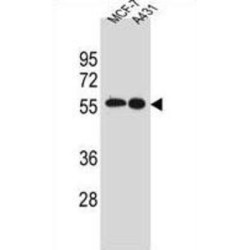 SRC Proto-Oncogene, Non-Receptor Tyrosine Kinase (SRC) Antibody