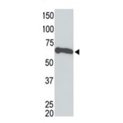 Myc Tag Antibody