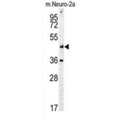 Myc Tag Antibody