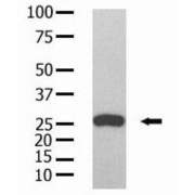 Glutathione S-Transferase (GST) Antibody