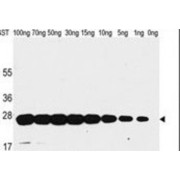 Glutathione S-Transferase (GST) Antibody