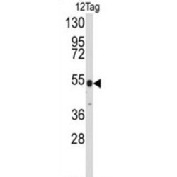 V5 Tag Antibody