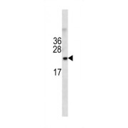 Transmembrane Protein 199 (TMEM199) Antibody