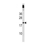 Zinc Finger Protein 740 (ZNF740) Antibody