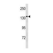 DNA Helicase MCM9 (MCM9) Antibody