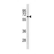 TATA-Box Binding Protein Associated Factor, RNA Polymerase I Subunit B (TAF1B) Antibody