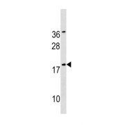 Sorting Nexin 12 (SNX12) Antibody