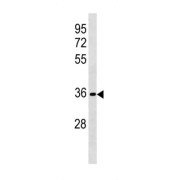 Ret Finger Protein-Like 3 (RFPL3) Antibody