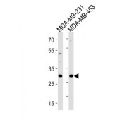 Ankyrin Repeat And SOCS Box Containing 11 (ASB11) Antibody