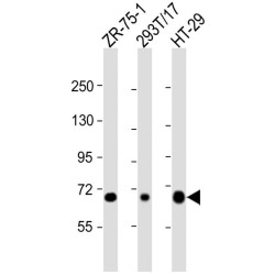 Sodium/Nucleoside Cotransporter 1 (SLC28A1) Antibody