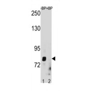 Zinc Finger Matrin-Type Protein 1 (ZMAT1) Antibody